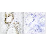Immunohistochemistry - Anti-FANCA Antibody (B1148) - Antibodies.com