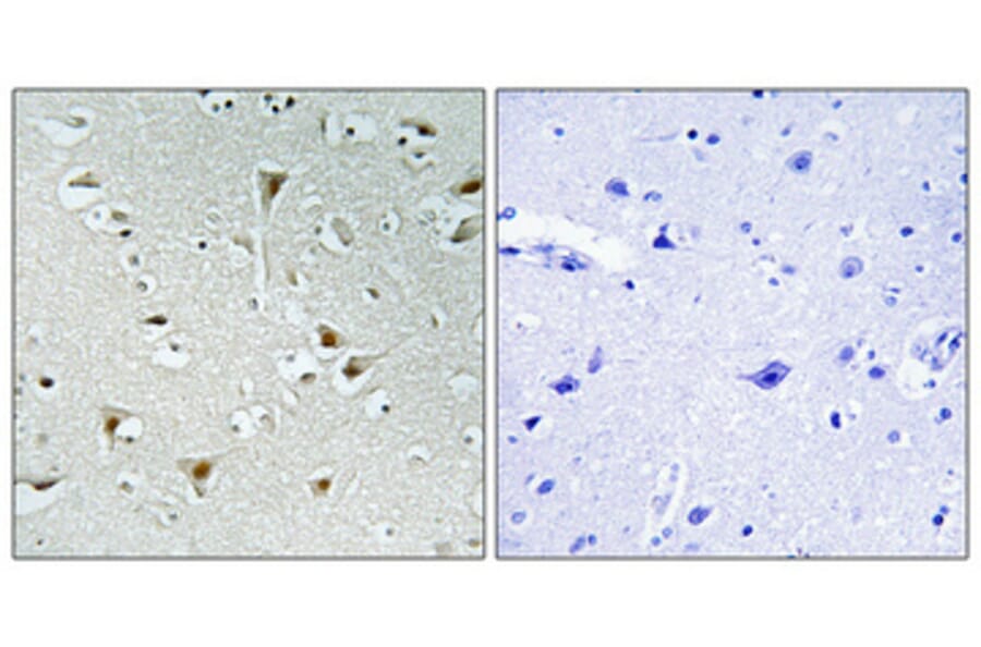 Immunohistochemistry - Anti-F111B Antibody (C11231) - Antibodies.com