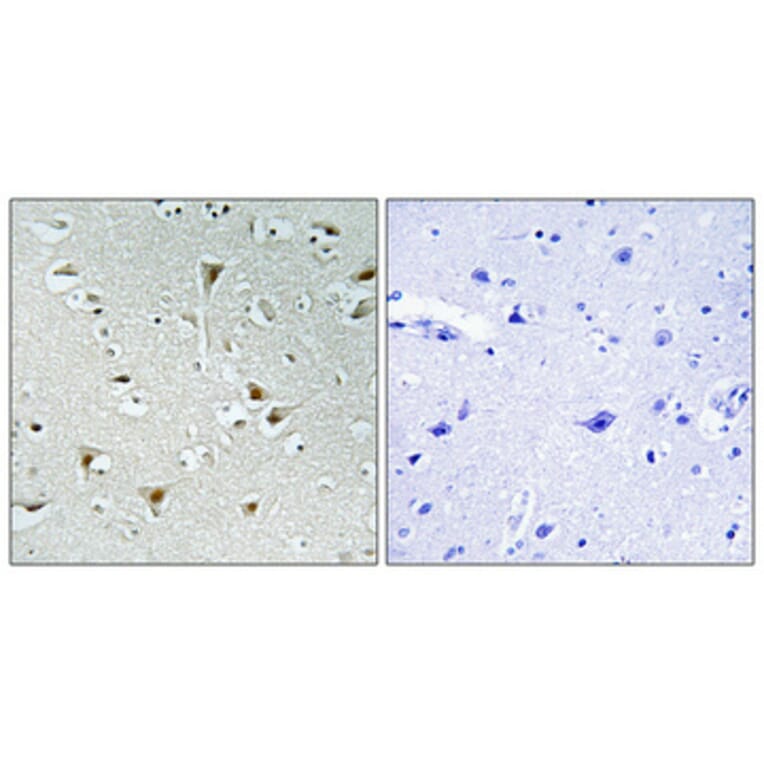Immunohistochemistry - Anti-F111B Antibody (C11231) - Antibodies.com