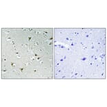 Immunohistochemistry - Anti-F111B Antibody (C11231) - Antibodies.com