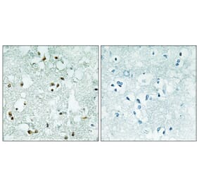 Immunohistochemistry - Anti-ELAC2 Antibody (C11594) - Antibodies.com