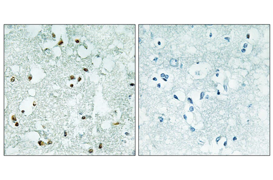 Immunohistochemistry - Anti-ELAC2 Antibody (C11594) - Antibodies.com