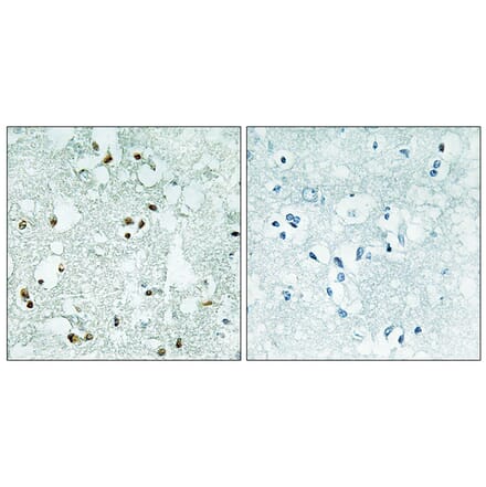 Immunohistochemistry - Anti-ELAC2 Antibody (C11594) - Antibodies.com