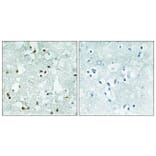 Immunohistochemistry - Anti-ELAC2 Antibody (C11594) - Antibodies.com