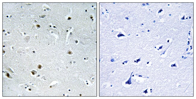 Immunohistochemical analysis of paraffin-embedded human brain using Anti-DDX24 Antibody. The right hand panel represents a negative control, where the antibody was pre-incubated with the immunising peptide.