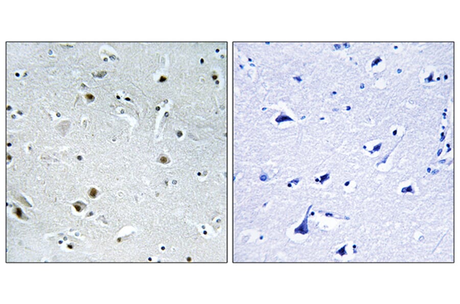 Immunohistochemistry - Anti-DDX24 Antibody (C14649) - Antibodies.com