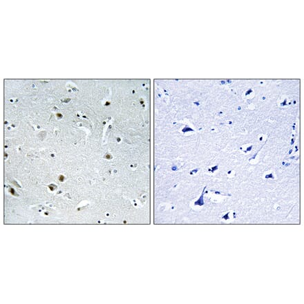 Immunohistochemistry - Anti-DDX24 Antibody (C14649) - Antibodies.com