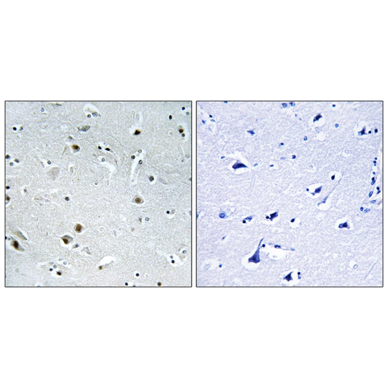 Immunohistochemistry - Anti-DDX24 Antibody (C14649) - Antibodies.com