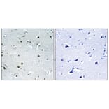 Immunohistochemistry - Anti-DDX24 Antibody (C14649) - Antibodies.com