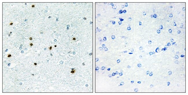 Immunohistochemical analysis of paraffin-embedded human brain using Anti-DCLK3 Antibody. The right hand panel represents a negative control, where the antibody was pre-incubated with the immunising peptide.