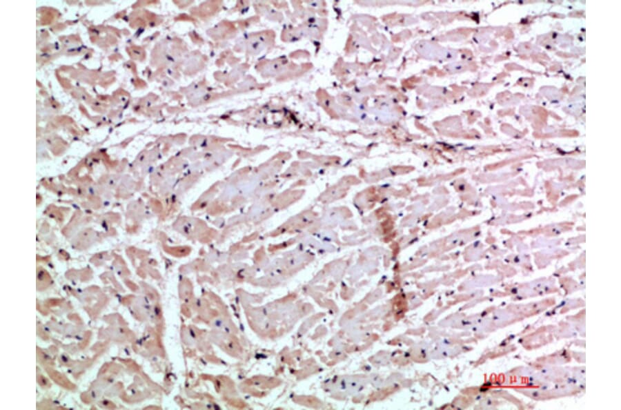 Immunohistochemistry - Anti-CXCL3 Antibody (C30687) - Antibodies.com