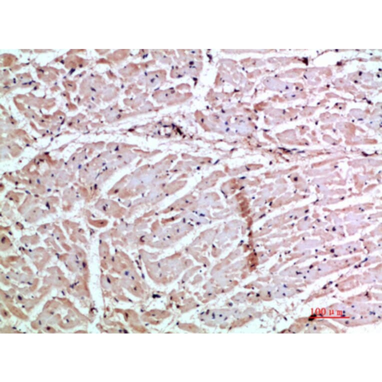 Immunohistochemistry - Anti-CXCL3 Antibody (C30687) - Antibodies.com