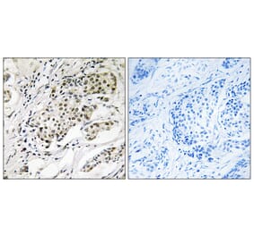 Immunohistochemistry - Anti-CDYL2 Antibody (C15112) - Antibodies.com