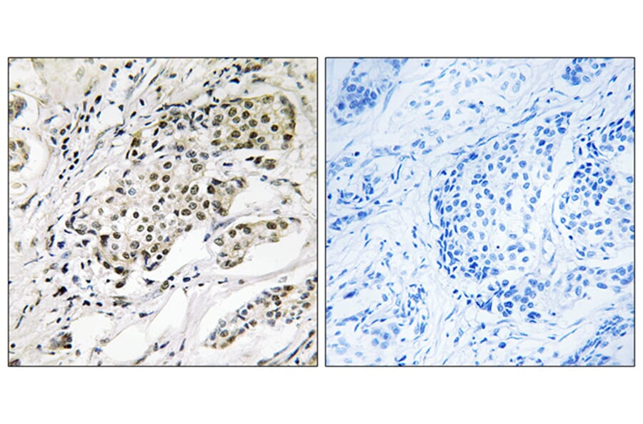 Immunohistochemistry - Anti-CDYL2 Antibody (C15112) - Antibodies.com