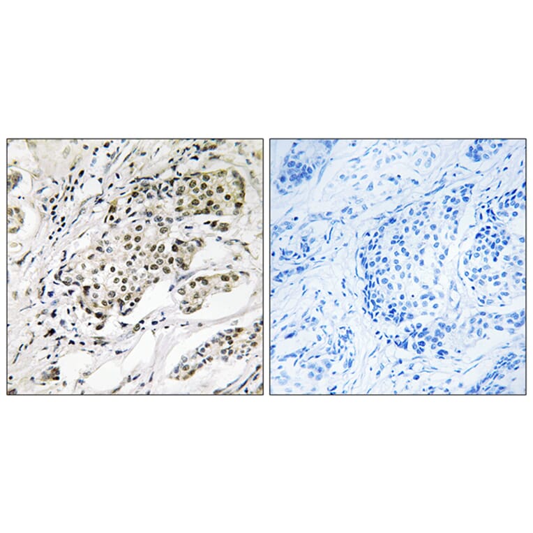 Immunohistochemistry - Anti-CDYL2 Antibody (C15112) - Antibodies.com