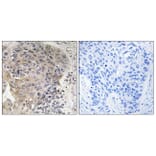 Immunohistochemistry - Anti-CBCP3 Antibody (C15301) - Antibodies.com