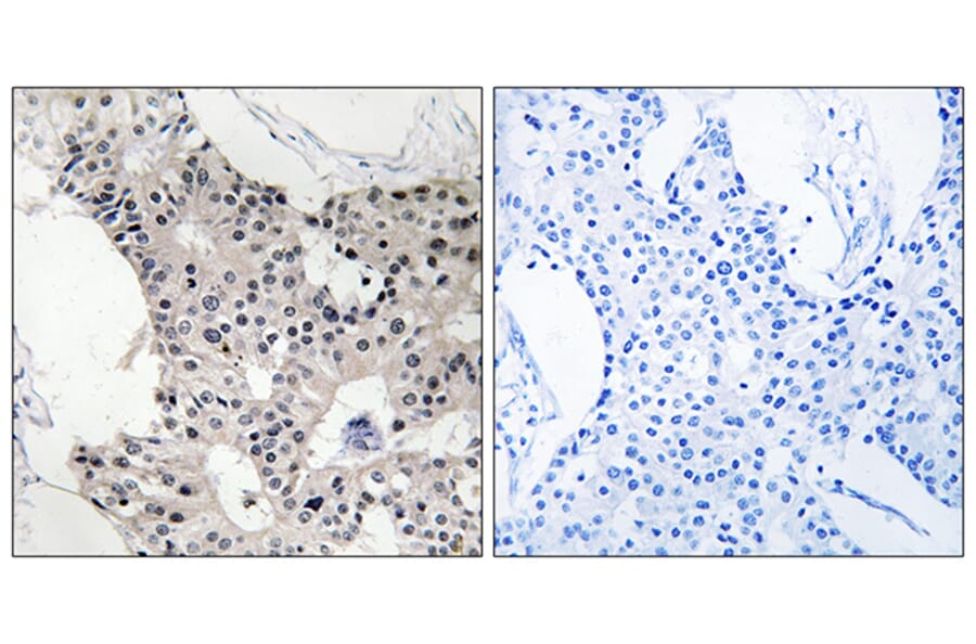 Immunohistochemistry - Anti-BAGE4 Antibody (C14677) - Antibodies.com