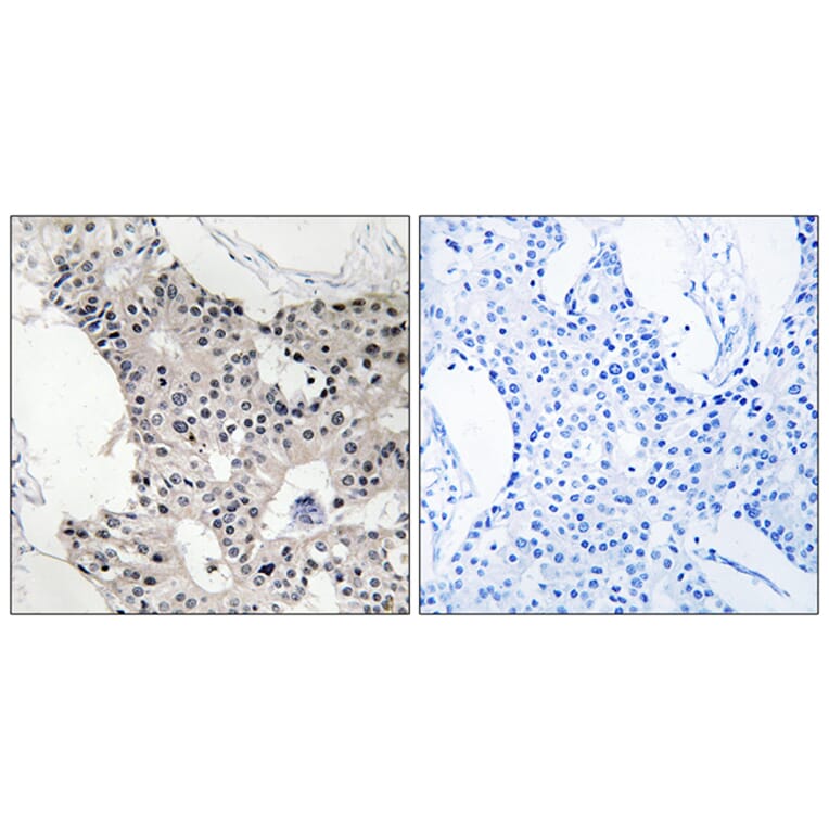 Immunohistochemistry - Anti-BAGE4 Antibody (C14677) - Antibodies.com