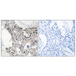 Immunohistochemistry - Anti-BAGE4 Antibody (C14677) - Antibodies.com