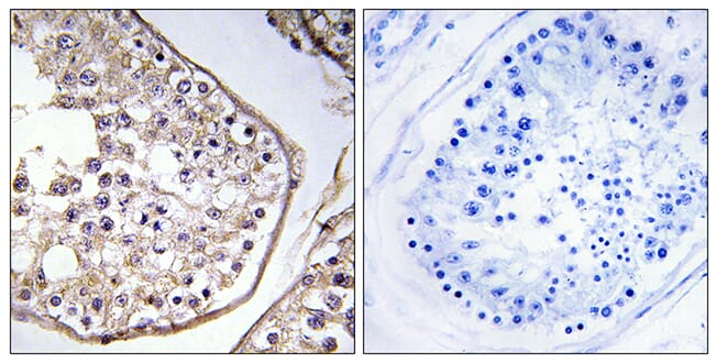 Immunohistochemical analysis of paraffin-embedded human testis using Anti-BAGE3 Antibody. The right hand panel represents a negative control, where the antibody was pre-incubated with the immunising peptide.