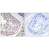 Immunohistochemistry - Anti-BAGE3 Antibody (C14676) - Antibodies.com