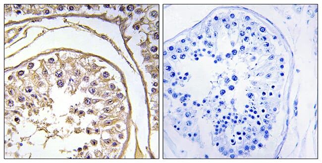 Immunohistochemical analysis of paraffin-embedded human testis using Anti-BAGE2 Antibody. The right hand panel represents a negative control, where the antibody was pre-incubated with the immunising peptide.