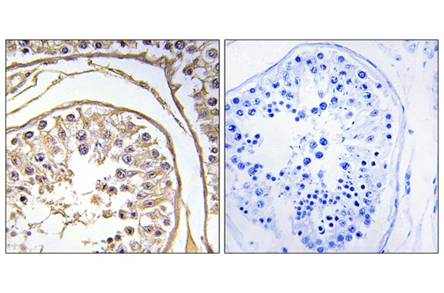Immunohistochemistry - Anti-BAGE2 Antibody (C14675) - Antibodies.com
