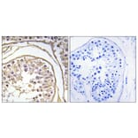 Immunohistochemistry - Anti-BAGE2 Antibody (C14675) - Antibodies.com