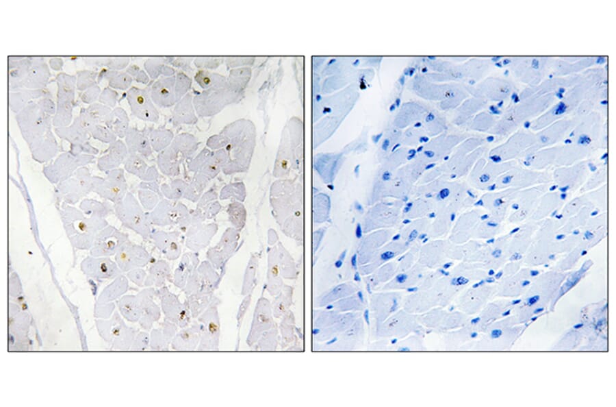 Immunohistochemistry - Anti-ALPK2 Antibody (C11273) - Antibodies.com