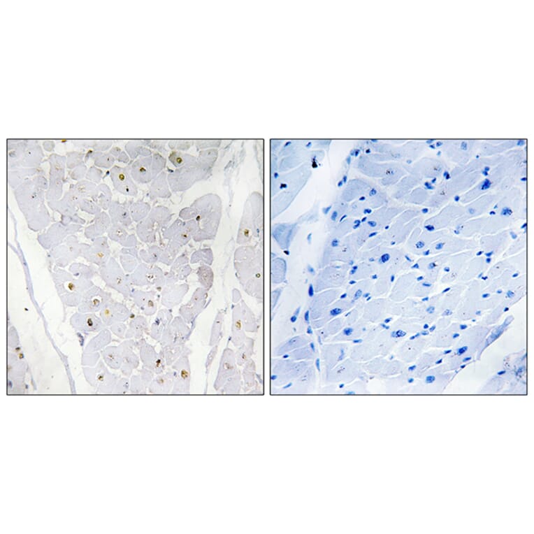 Immunohistochemistry - Anti-ALPK2 Antibody (C11273) - Antibodies.com