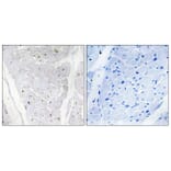 Immunohistochemistry - Anti-ALPK2 Antibody (C11273) - Antibodies.com