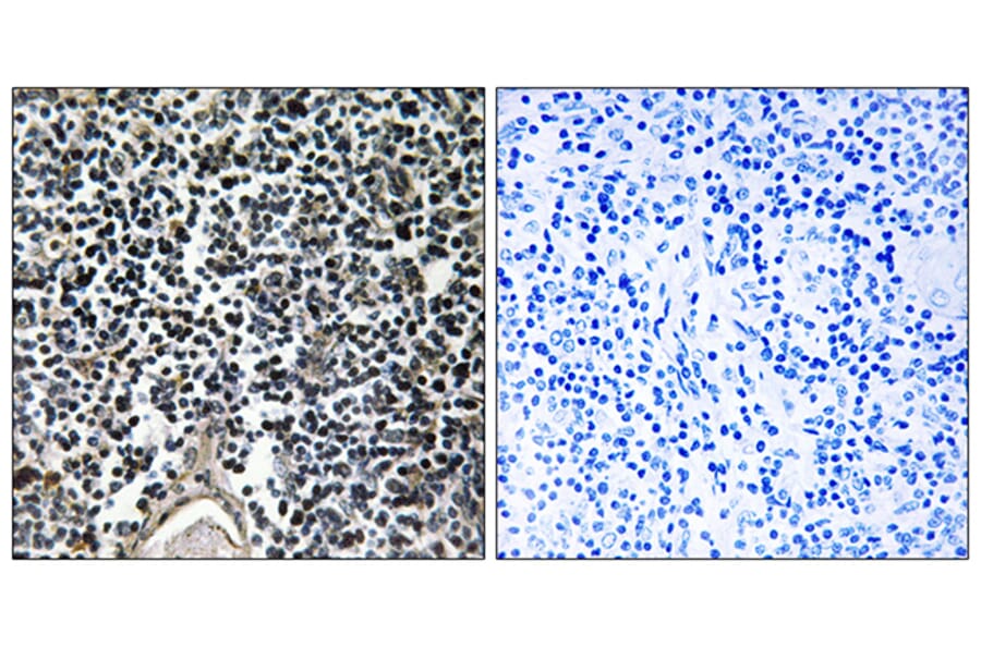 Immunohistochemistry - Anti-ABCB7 Antibody (C14621) - Antibodies.com