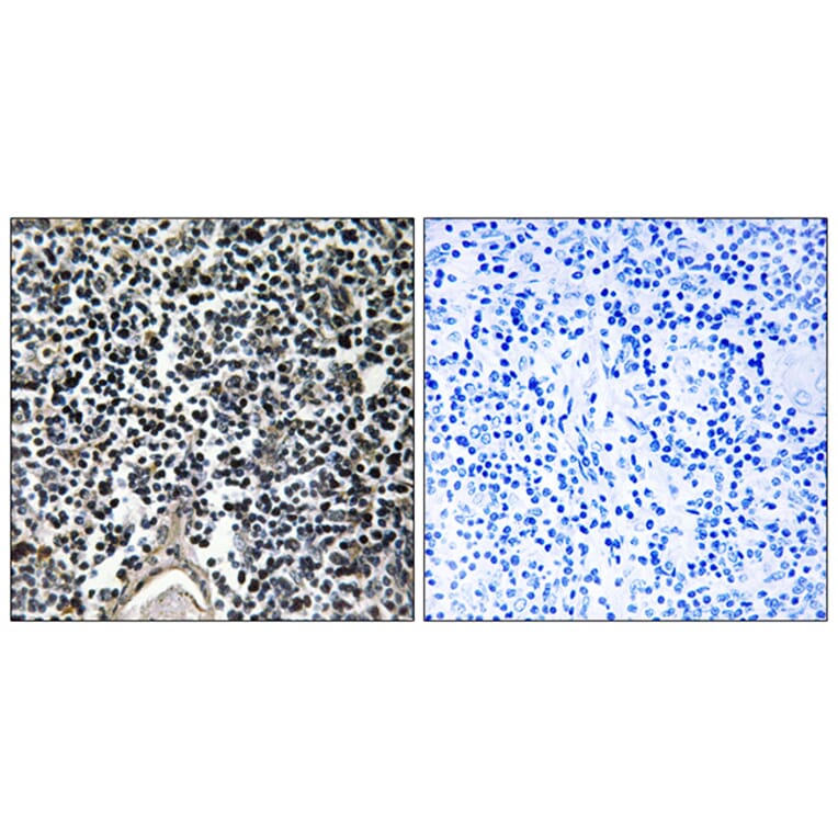 Immunohistochemistry - Anti-ABCB7 Antibody (C14621) - Antibodies.com