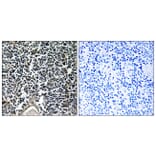 Immunohistochemistry - Anti-ABCB7 Antibody (C14621) - Antibodies.com