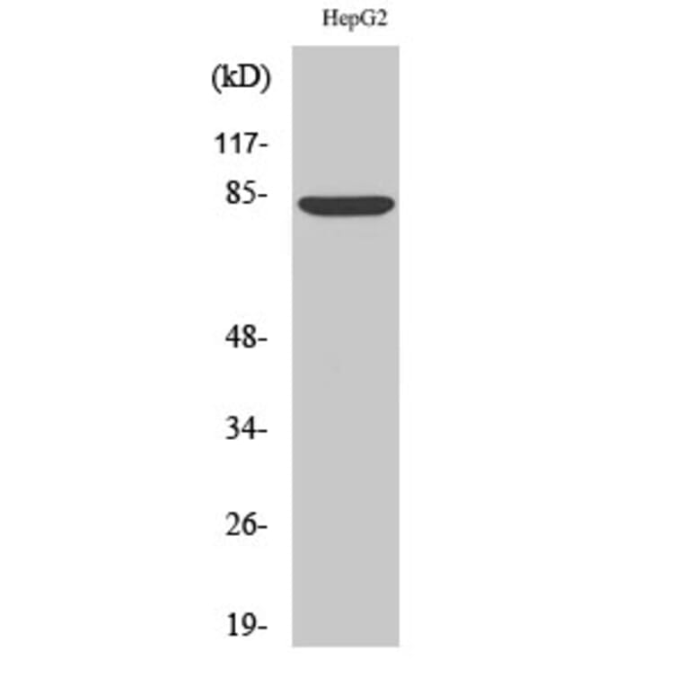 Western Blot - Anti-ABCB7 Antibody (C14621) - Antibodies.com