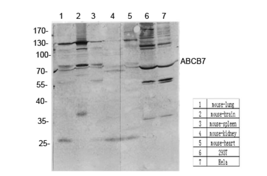 Western Blot - Anti-ABCB7 Antibody (C14621) - Antibodies.com