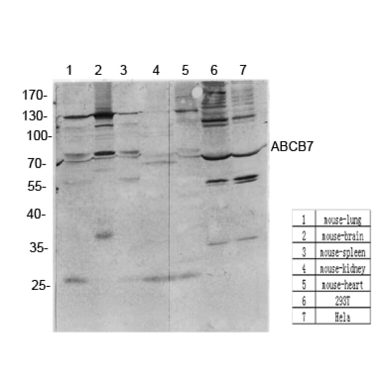 Western Blot - Anti-ABCB7 Antibody (C14621) - Antibodies.com