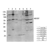 Western Blot - Anti-ABCB7 Antibody (C14621) - Antibodies.com