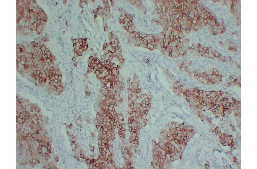 Immunohistochemistry - Anti-pS2 Antibody (V0145) - Antibodies.com