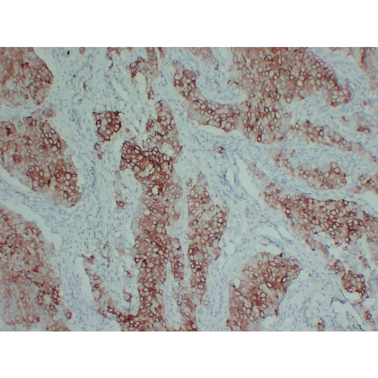 Immunohistochemistry - Anti-pS2 Antibody (V0145) - Antibodies.com