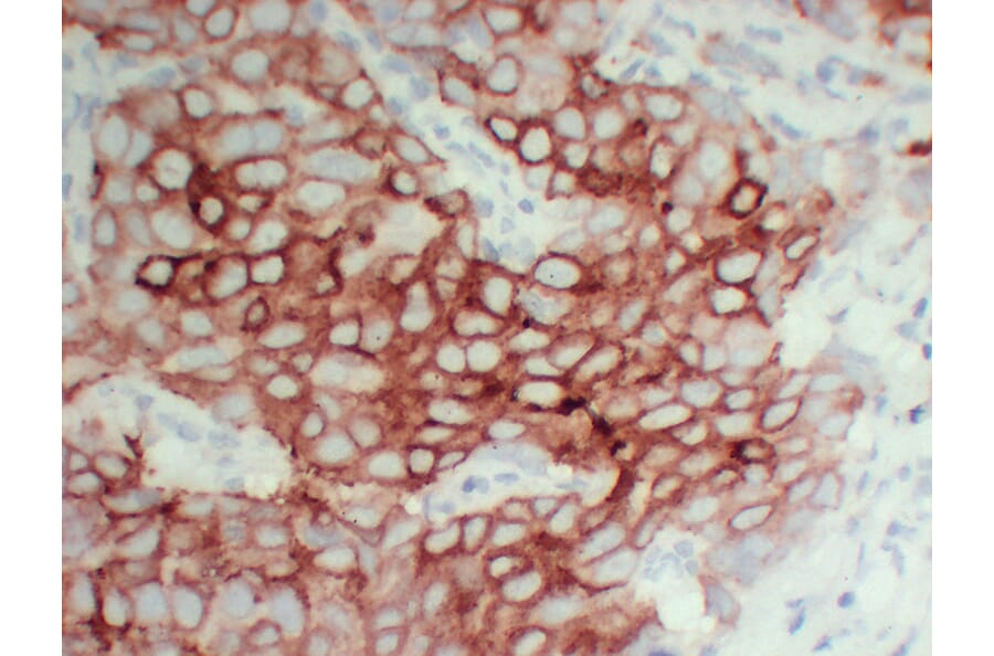 Immunohistochemistry - Anti-pS2 Antibody (V0145) - Antibodies.com