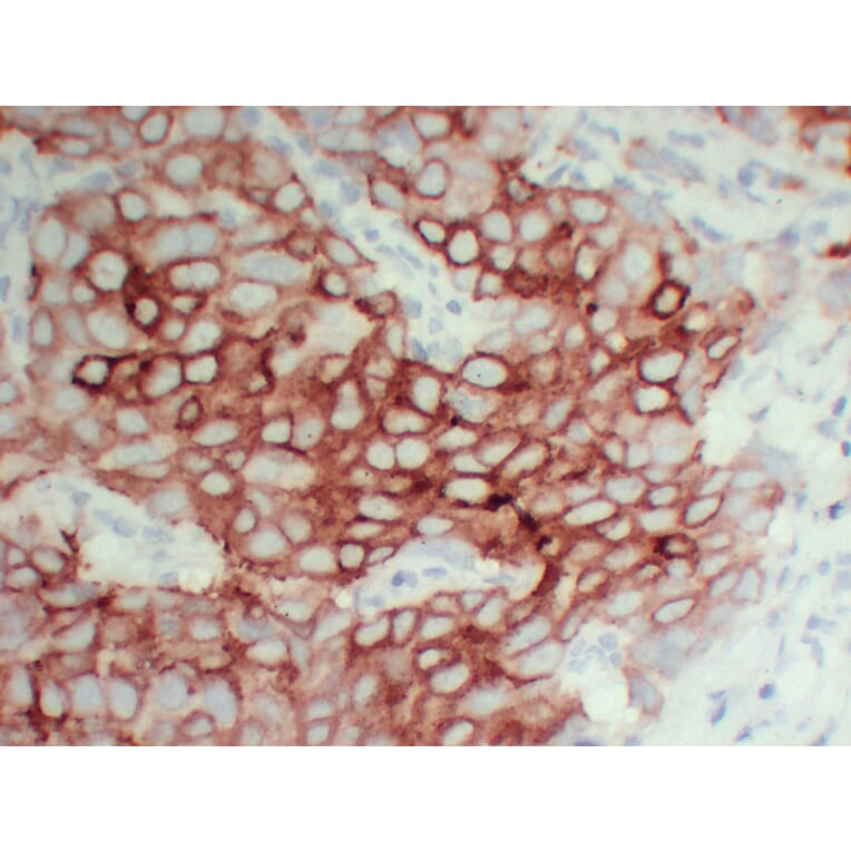 Immunohistochemistry - Anti-pS2 Antibody (V0145) - Antibodies.com