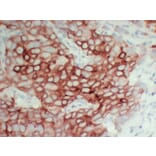 Immunohistochemistry - Anti-pS2 Antibody (V0145) - Antibodies.com