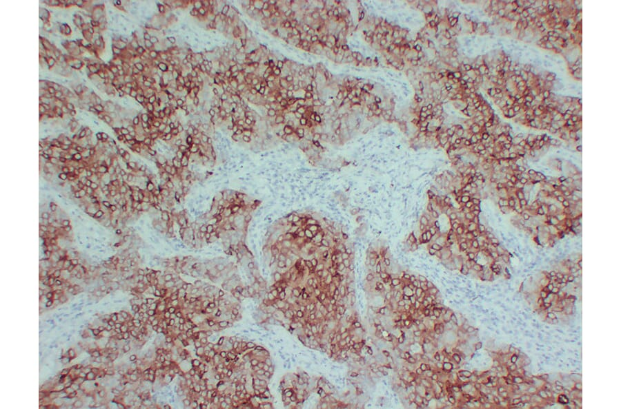 Immunohistochemistry - Anti-pS2 Antibody (V0145) - Antibodies.com