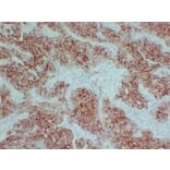 Immunohistochemistry - Anti-pS2 Antibody (V0145) - Antibodies.com