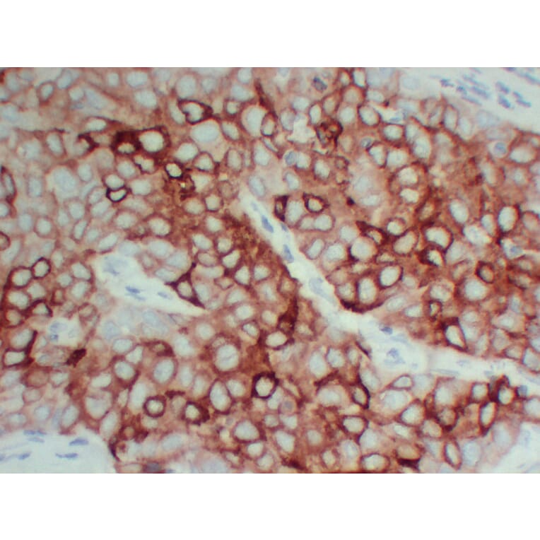 Immunohistochemistry - Anti-pS2 Antibody (V0145) - Antibodies.com