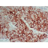 Immunohistochemistry - Anti-pS2 Antibody (V0145) - Antibodies.com