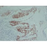 Immunohistochemistry - Anti-pS2 Antibody (V0145) - Antibodies.com