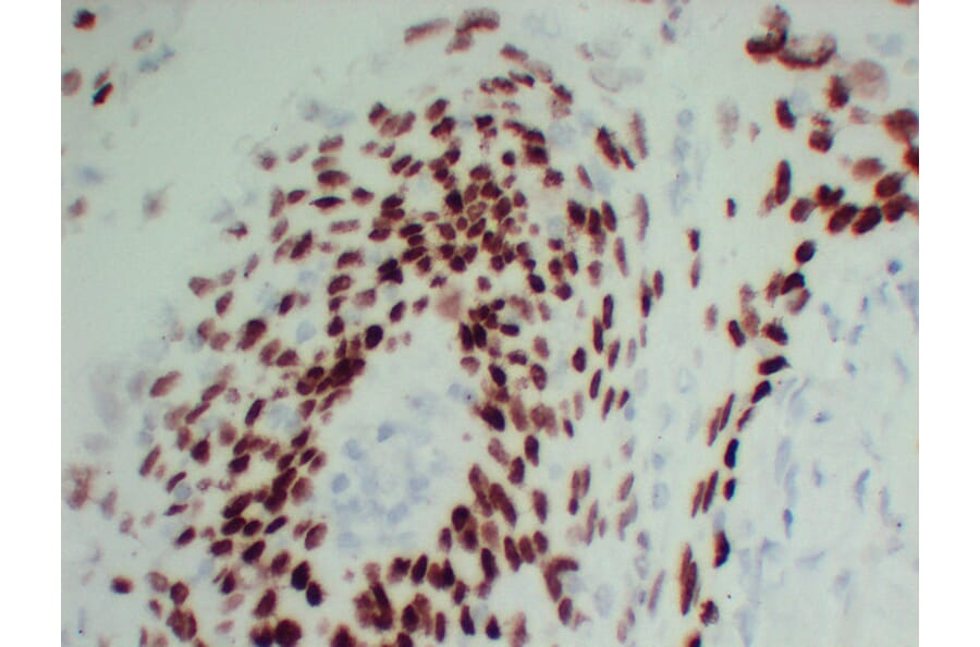 Immunohistochemistry - Anti-p40 Antibody (V0144) - Antibodies.com