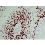 Immunohistochemistry - Anti-p40 Antibody (V0144) - Antibodies.com